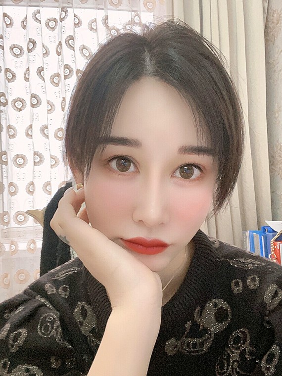 只要额头变得扁平,侧颜看起来 不言而喻 北京东方和谐自体脂肪填充多少钱?冯斌怎么样?【点击咨询】