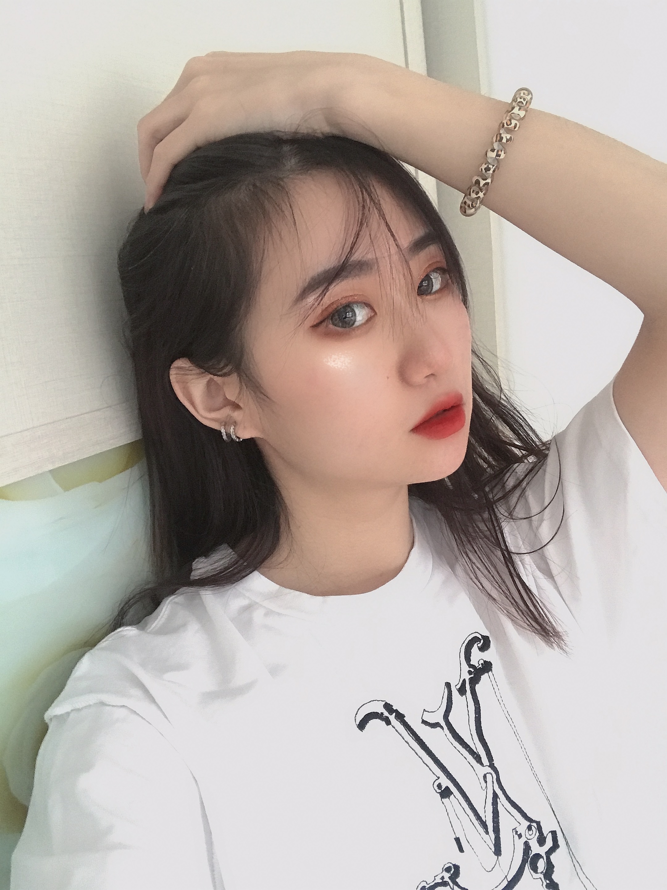 我的鼻子整体上恢复的很好,鼻子上面也没有出现挛缩的情况,北京刘风卓隆鼻案例