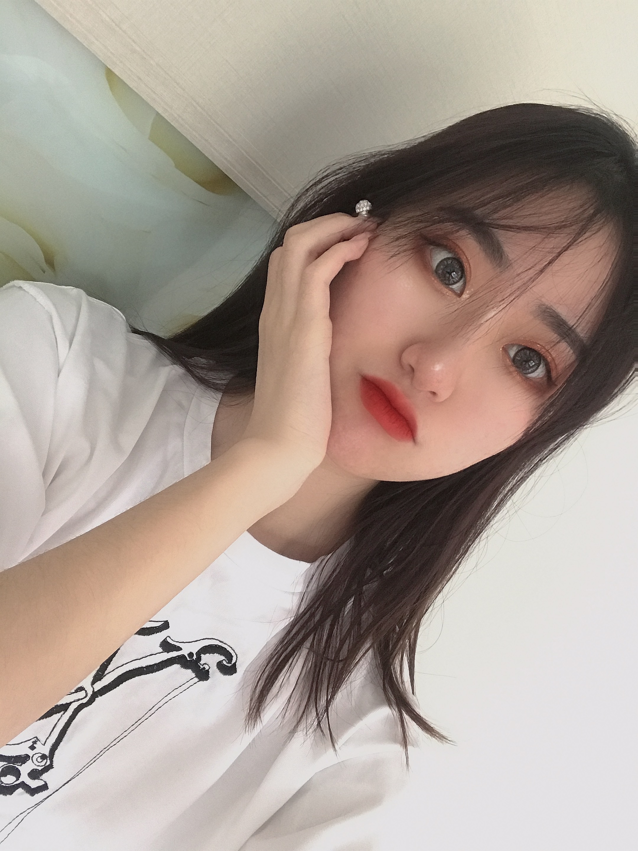 我的鼻子整体上恢复的很好,鼻子上面也没有出现挛缩的情况,北京刘风卓隆鼻案例