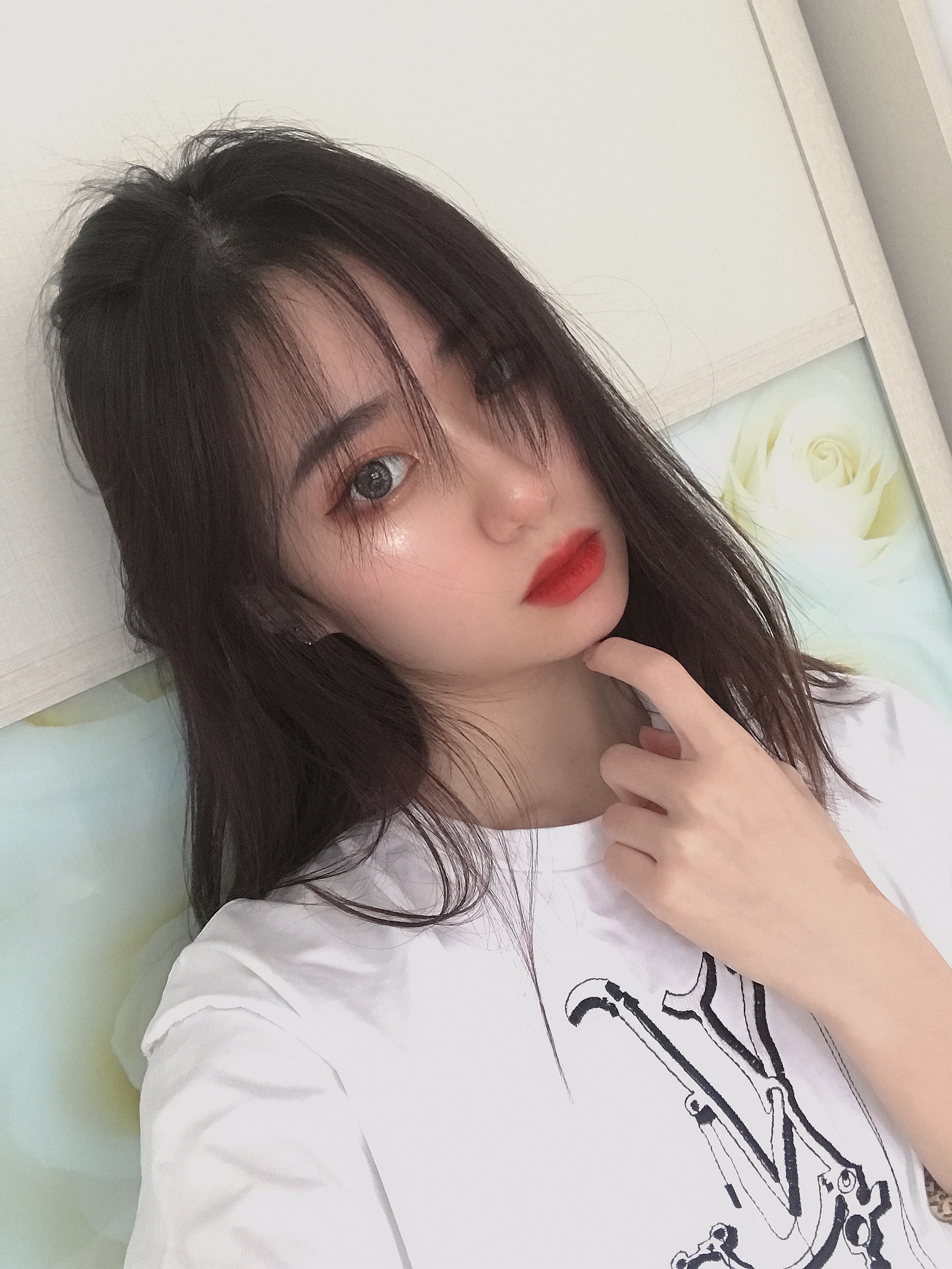 我的鼻子整体上恢复的很好,鼻子上面也没有出现挛缩的情况,北京刘风卓隆鼻案例