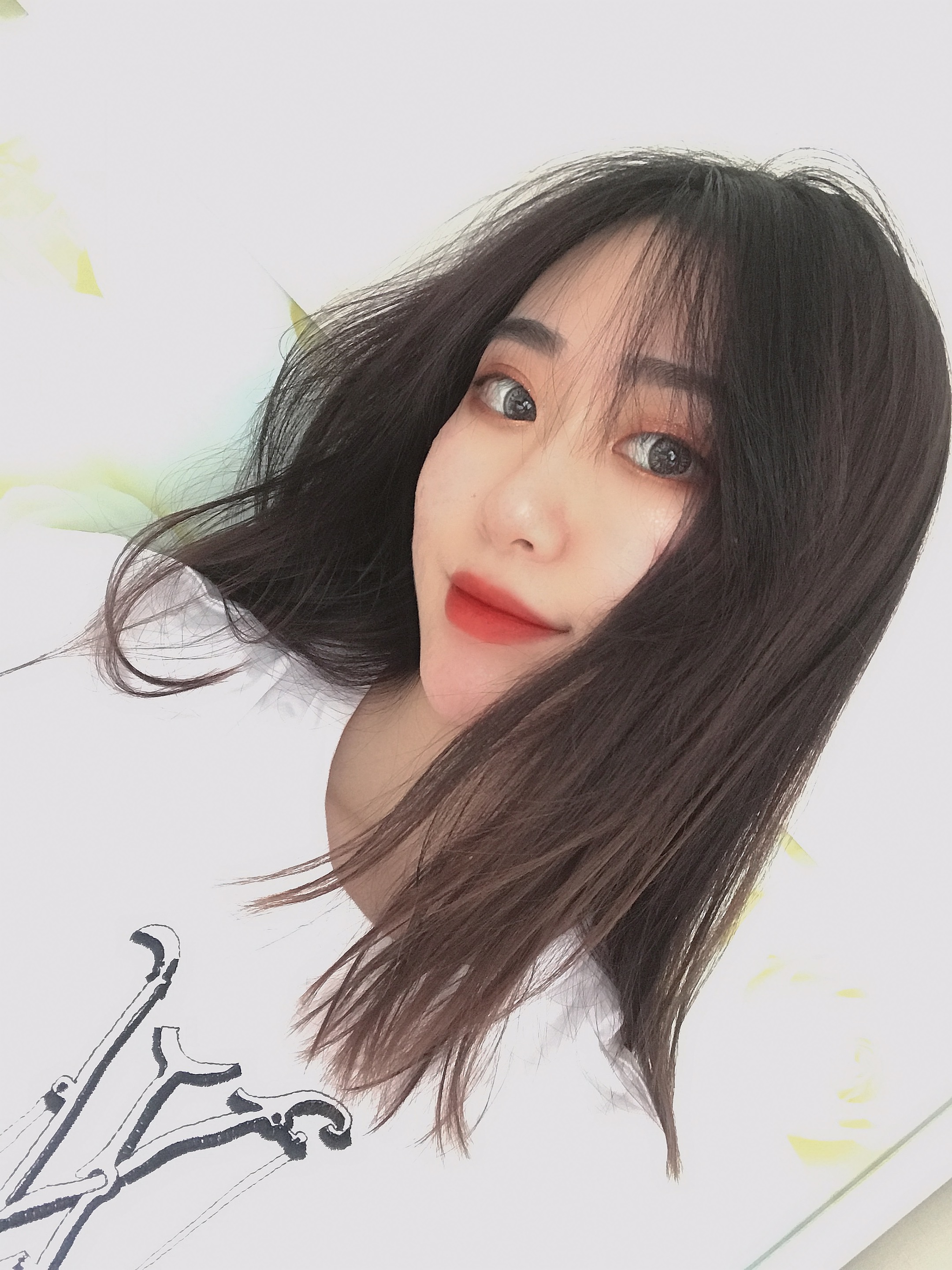 我的鼻子整体上恢复的很好,鼻子上面也没有出现挛缩的情况,北京刘风卓隆鼻案例