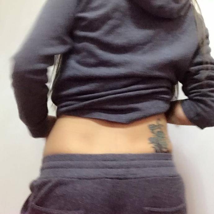 今天是手术过后的第四天,看这自己真的瘦了很多,郑州大学第二附属医院吸脂案例图