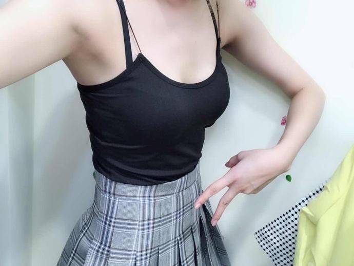 今天是手术过后的第四天,看这自己真的瘦了很多,郑州大学第二附属医院吸脂案例图