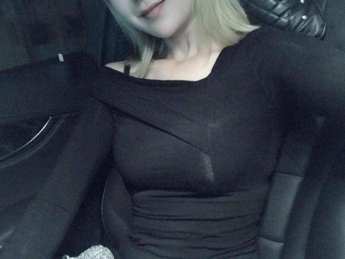 今天是手术过后的第四天,看这自己真的瘦了很多,郑州大学第二附属医院吸脂案例图