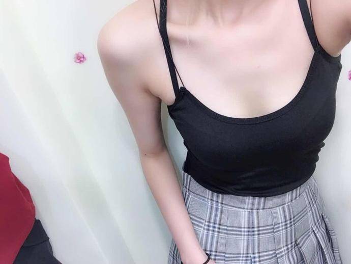 今天是手术过后的第四天,看这自己真的瘦了很多,郑州大学第二附属医院吸脂案例图
