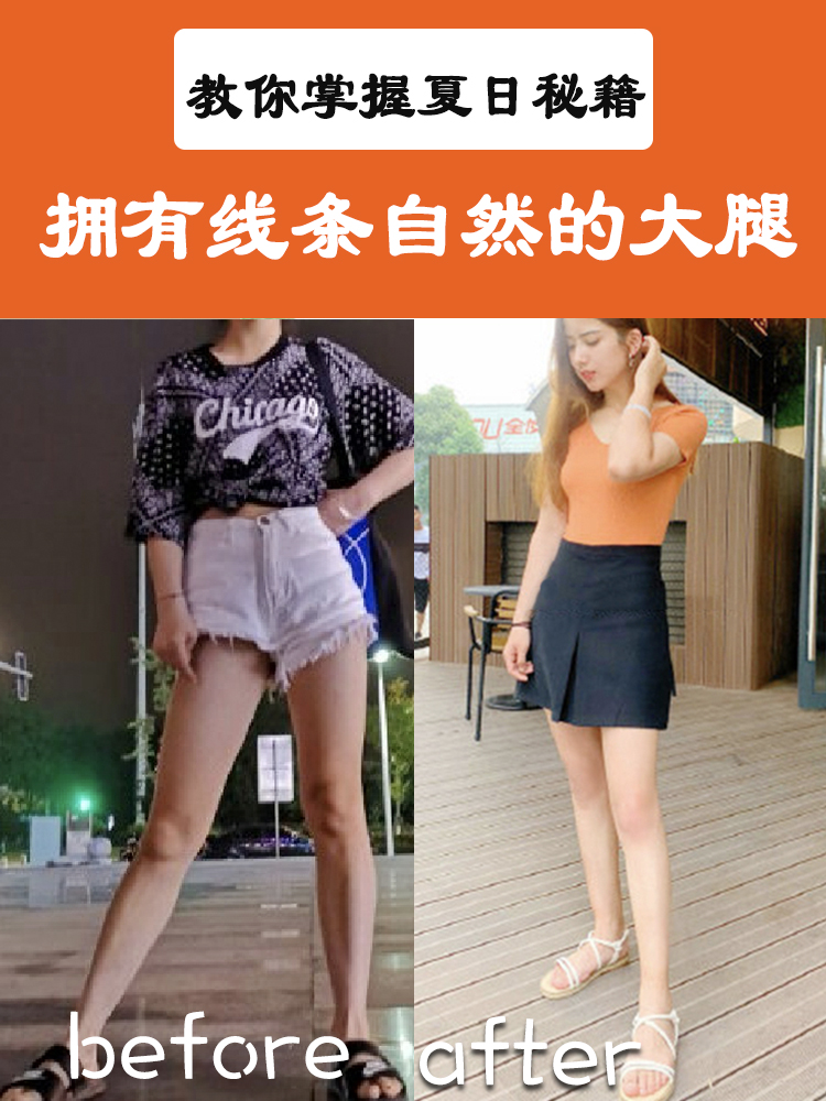 大腿两侧脂肪堆积过多,导致大腿腿型比例失衡 重庆曹阳丽格大腿吸脂案例