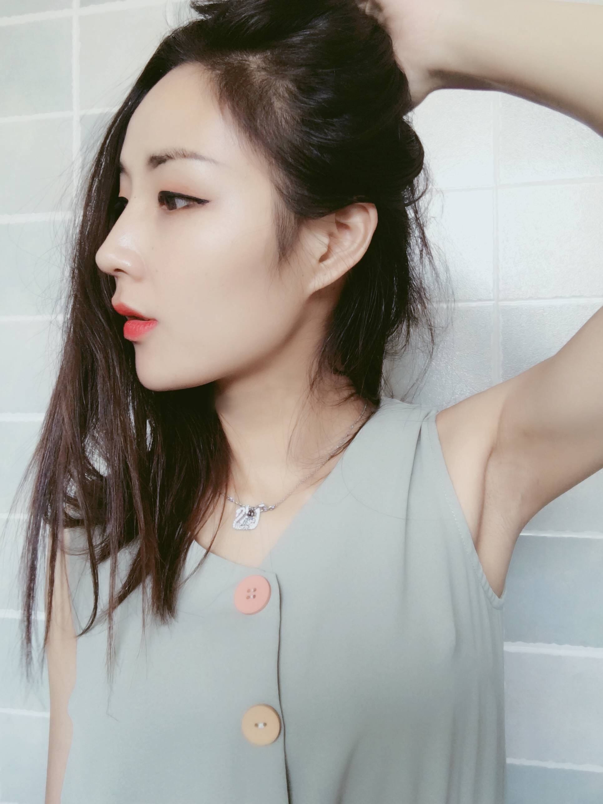 成都润美玉之光黄开亮隆鼻价格多少钱?好不好?案例图
