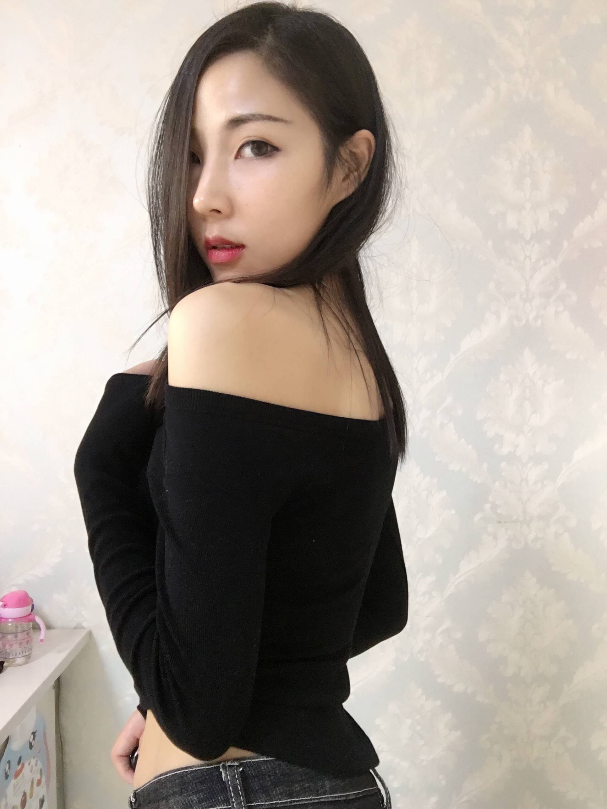 成都润美玉之光黄开亮隆鼻价格多少钱?好不好?案例图