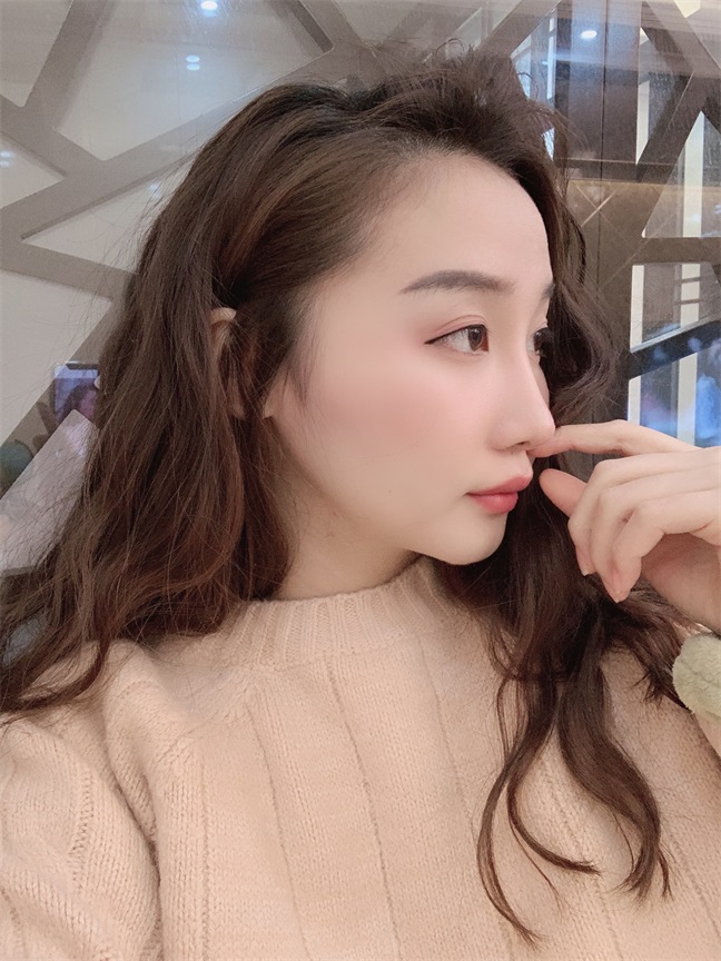 中国沈阳医大口腔医院磨骨多少钱?刘强 杨鸣良 张蕾技术怎么样?案例图
