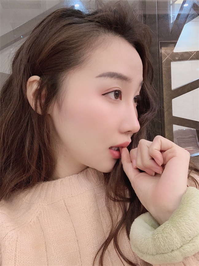 中国沈阳医大口腔医院磨骨多少钱?刘强 杨鸣良 张蕾技术怎么样?案例图