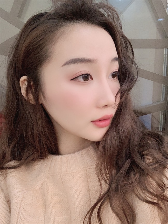中国沈阳医大口腔医院磨骨多少钱?刘强 杨鸣良 张蕾技术怎么样?案例图