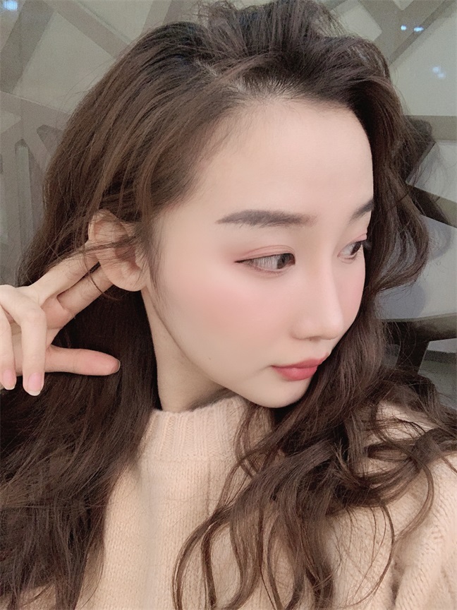 中国沈阳医大口腔医院磨骨多少钱?刘强 杨鸣良 张蕾技术怎么样?案例图