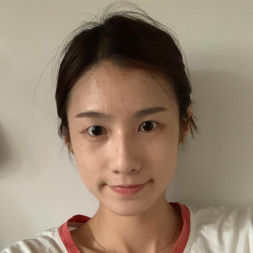 单眼皮显得我的眼睛很小,然鹅身边大多数朋友都是双眼皮 保定华美整形割双眼皮案例图