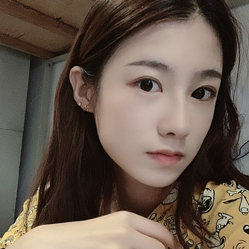 单眼皮显得我的眼睛很小,然鹅身边大多数朋友都是双眼皮 保定华美整形割双眼皮案例图