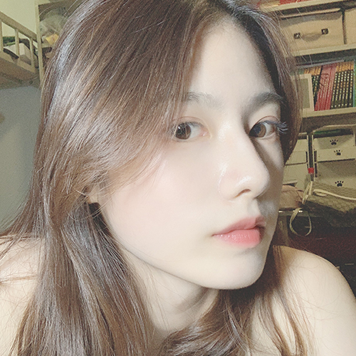 单眼皮显得我的眼睛很小,然鹅身边大多数朋友都是双眼皮 保定华美整形割双眼皮案例图