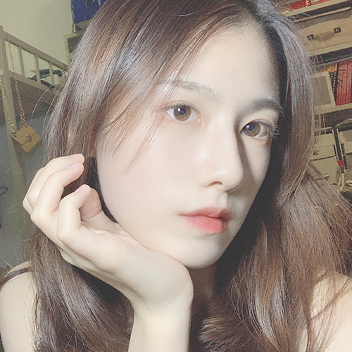 单眼皮显得我的眼睛很小,然鹅身边大多数朋友都是双眼皮 保定华美整形割双眼皮案例图