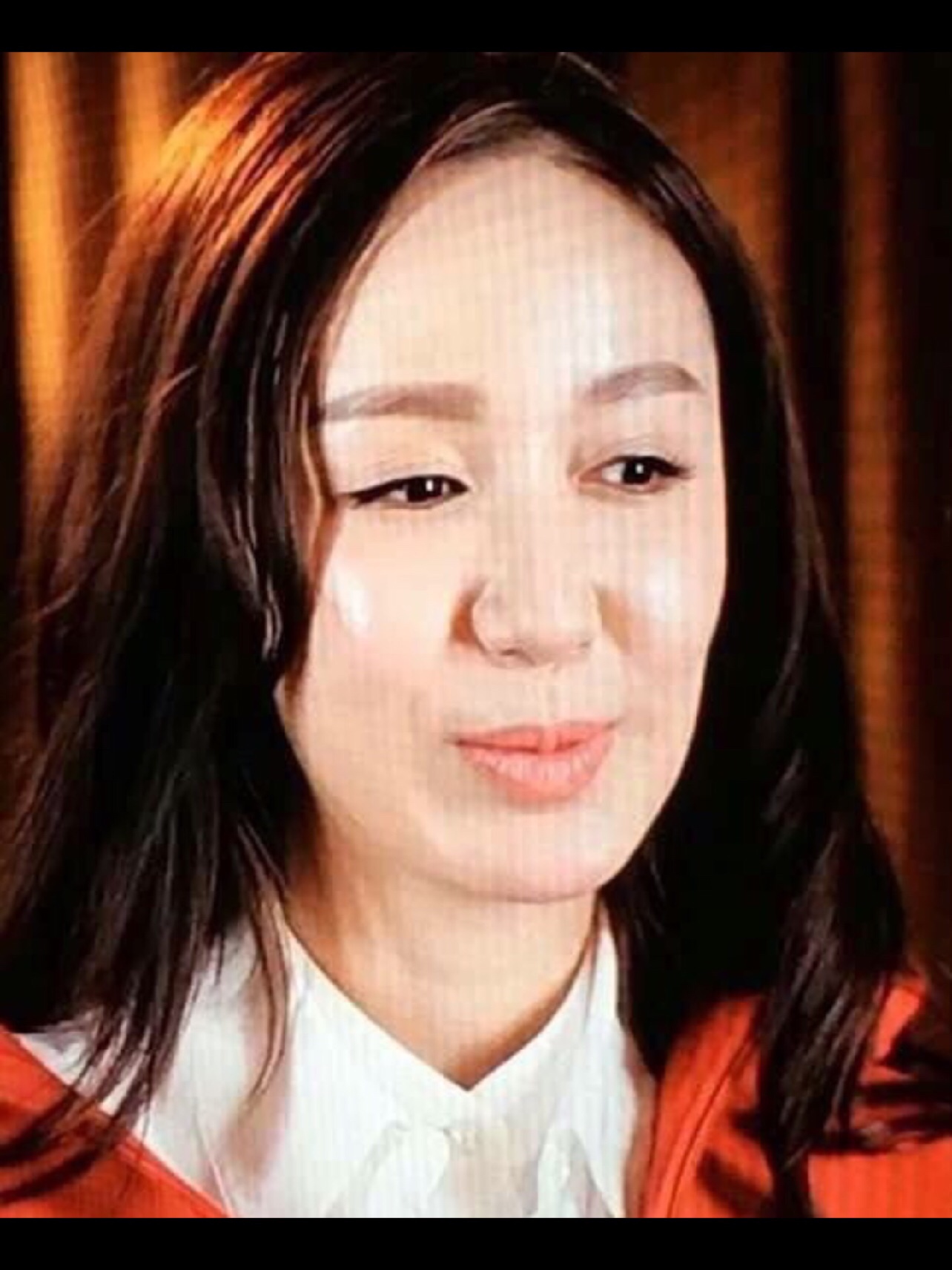 娄艺潇怎么会垮成这样?面部自体脂肪填充需谨慎!