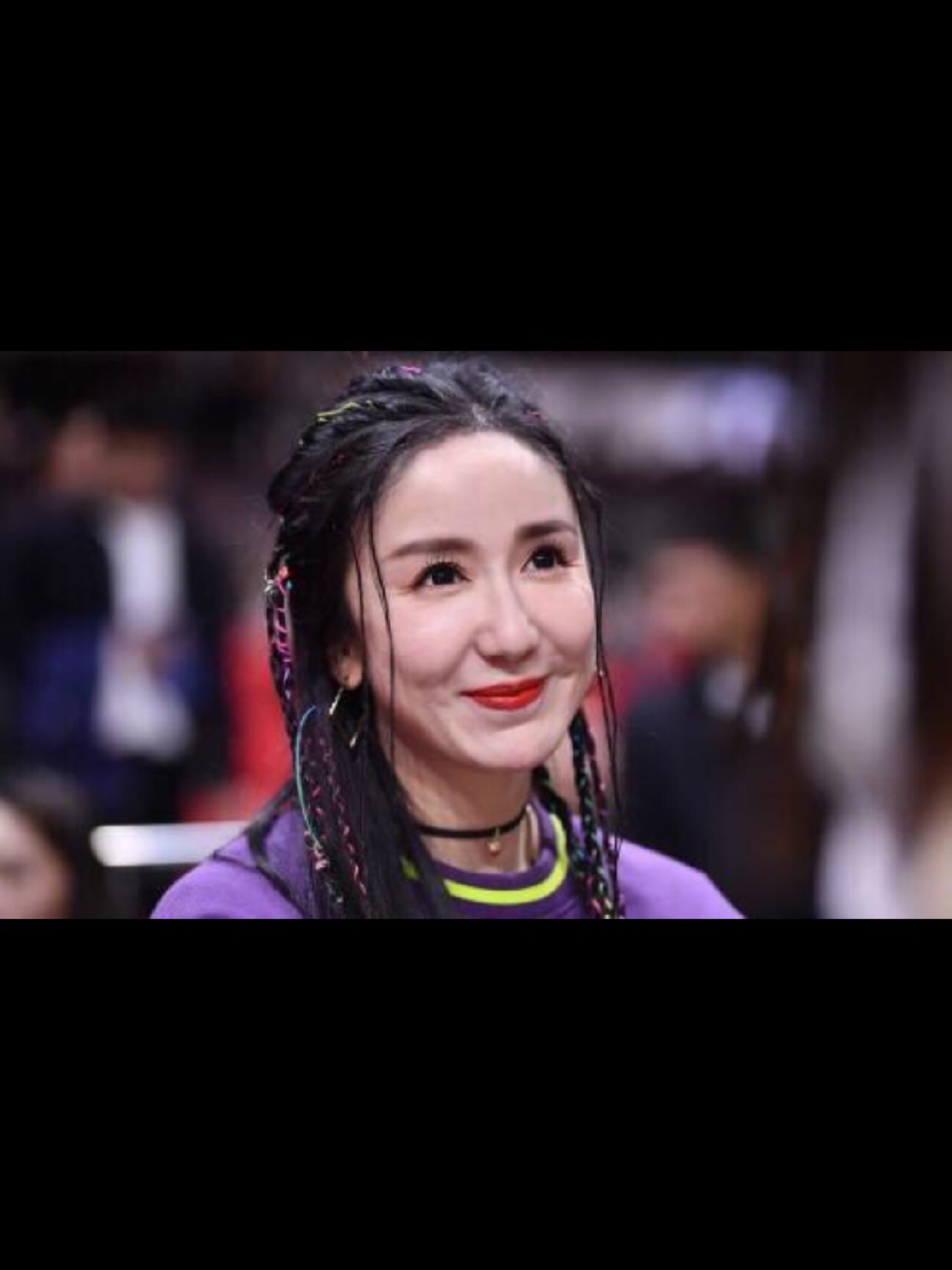 娄艺潇怎么会垮成这样?面部自体脂肪填充需谨慎!