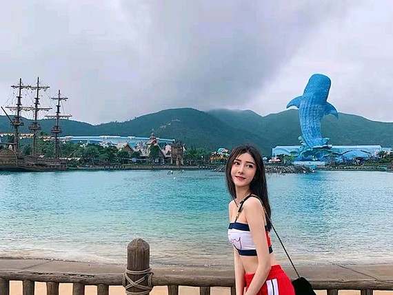 如今我的眼睛恢复的*自然，我男朋友现在还不知道我的眼睛是做的哈哈哈