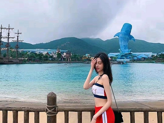 如今我的眼睛恢复的*自然，我男朋友现在还不知道我的眼睛是做的哈哈哈