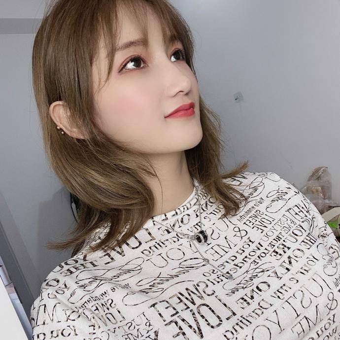 我们看一个人或者与人交流的时候,通常*先都会看Ta的眼睛 上海沪西医院张圆圆割双眼皮怎么样?案例图
