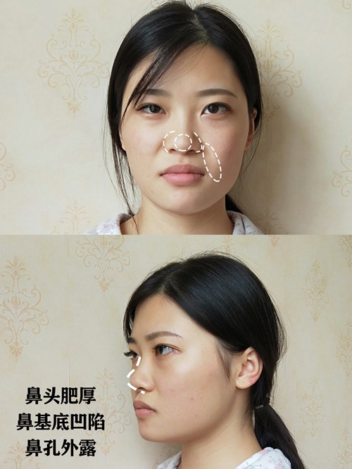 好看的鼻子对人的改变有多大?
