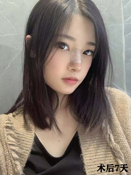 好看的鼻子对人的改变有多大?