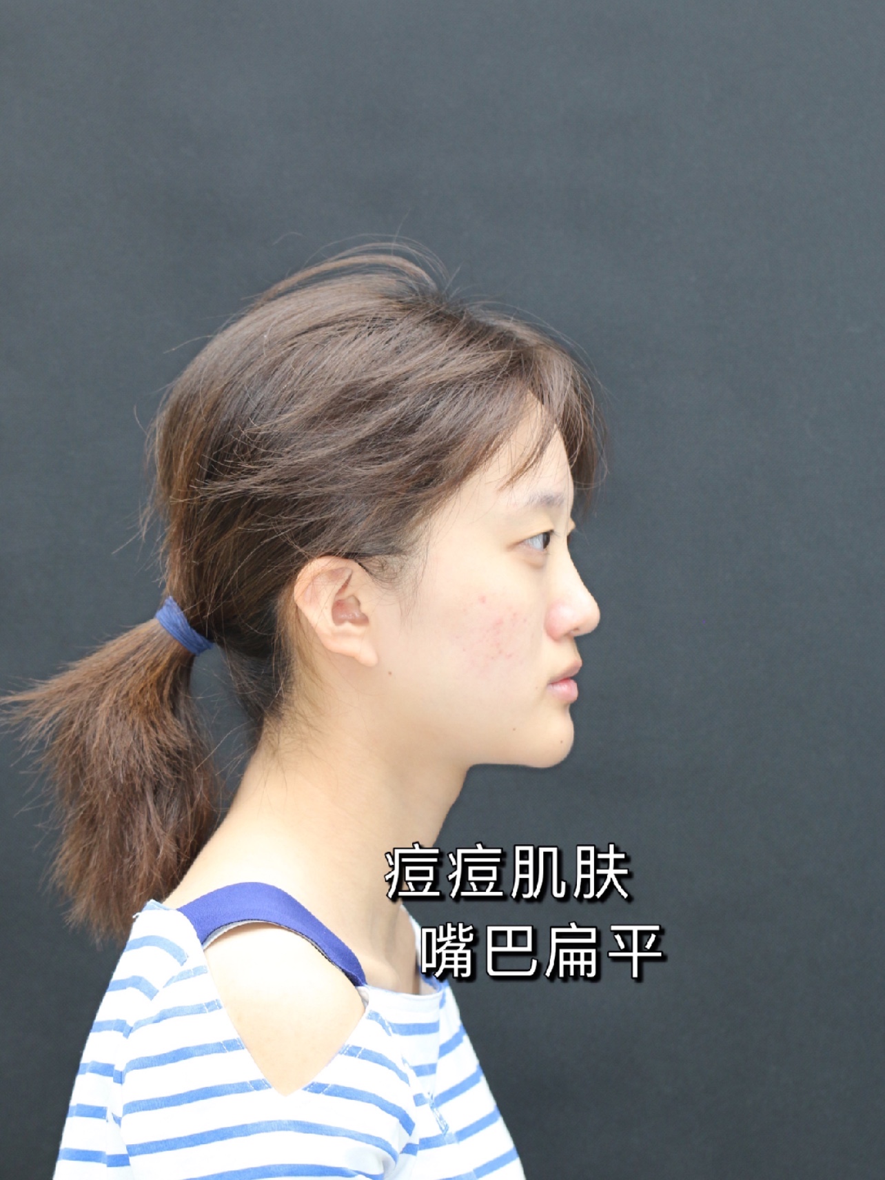 今天进行素人面部简单分析啦 面部轮廓流畅,皮肤白皙透亮,整体发际线高,发量浓密