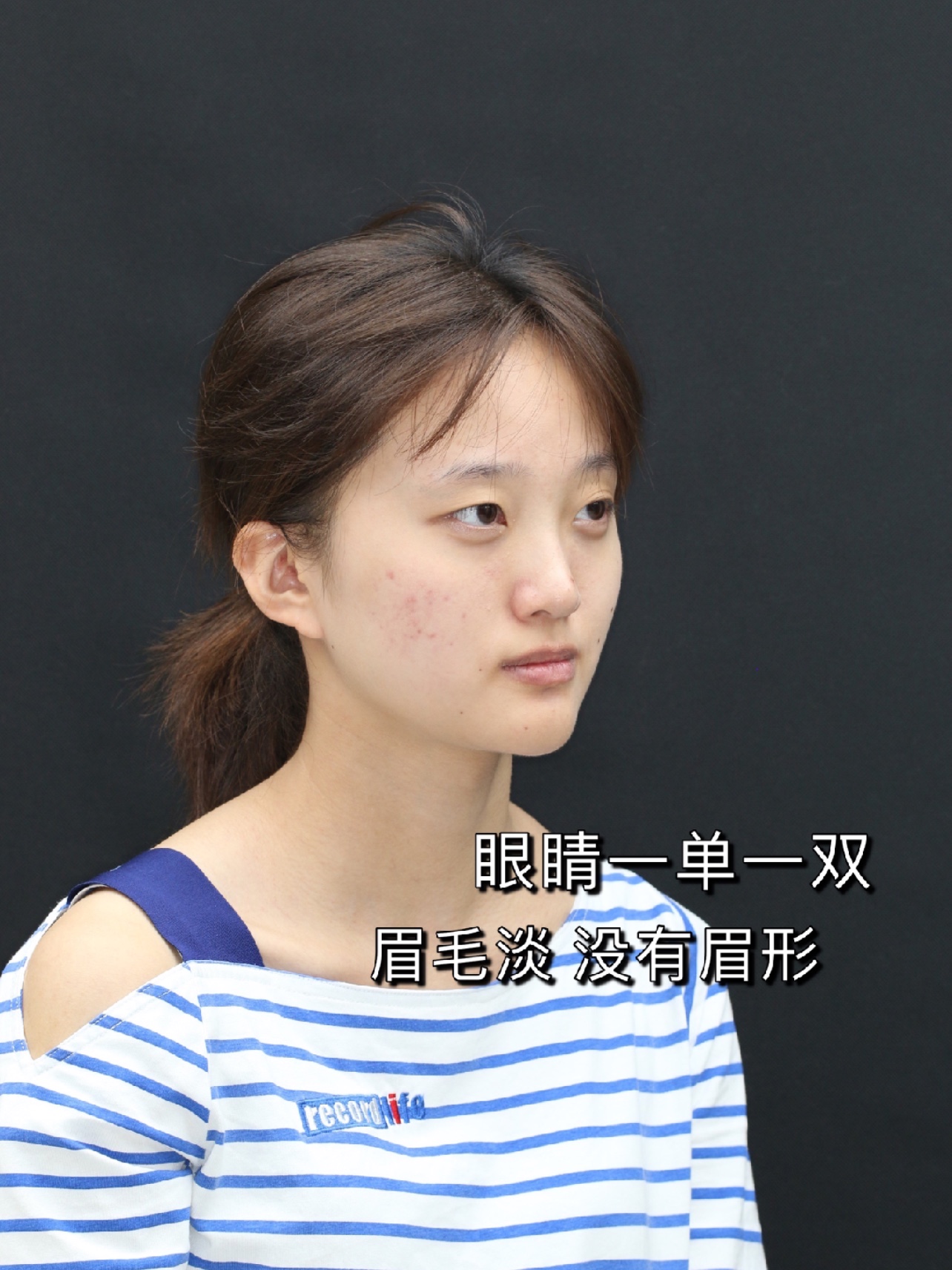 今天进行素人面部简单分析啦 面部轮廓流畅,皮肤白皙透亮,整体发际线高,发量浓密
