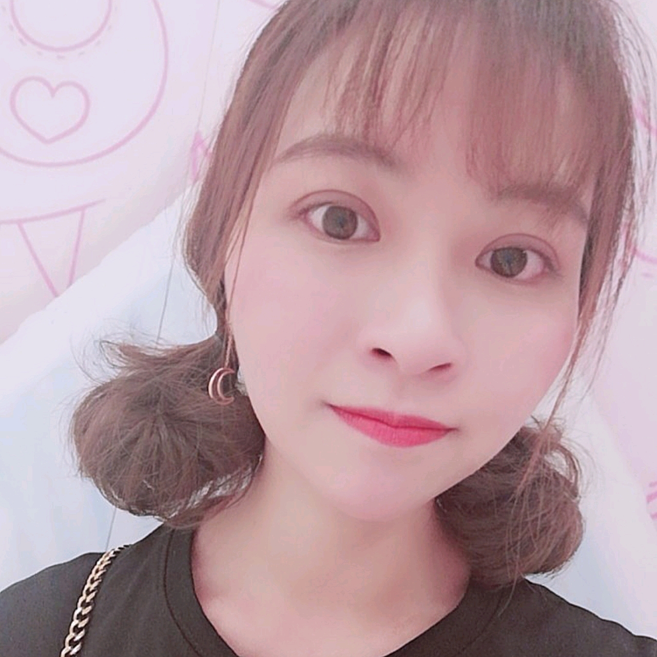 长沙雅美整形美容医院割双眼皮怎么样?多少钱?价格表、案例图