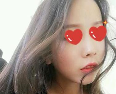 做软骨+假体隆鼻后,猪小鼻不见叻!芜湖伊莱美隆鼻技术怎么样?案例图好看吗?