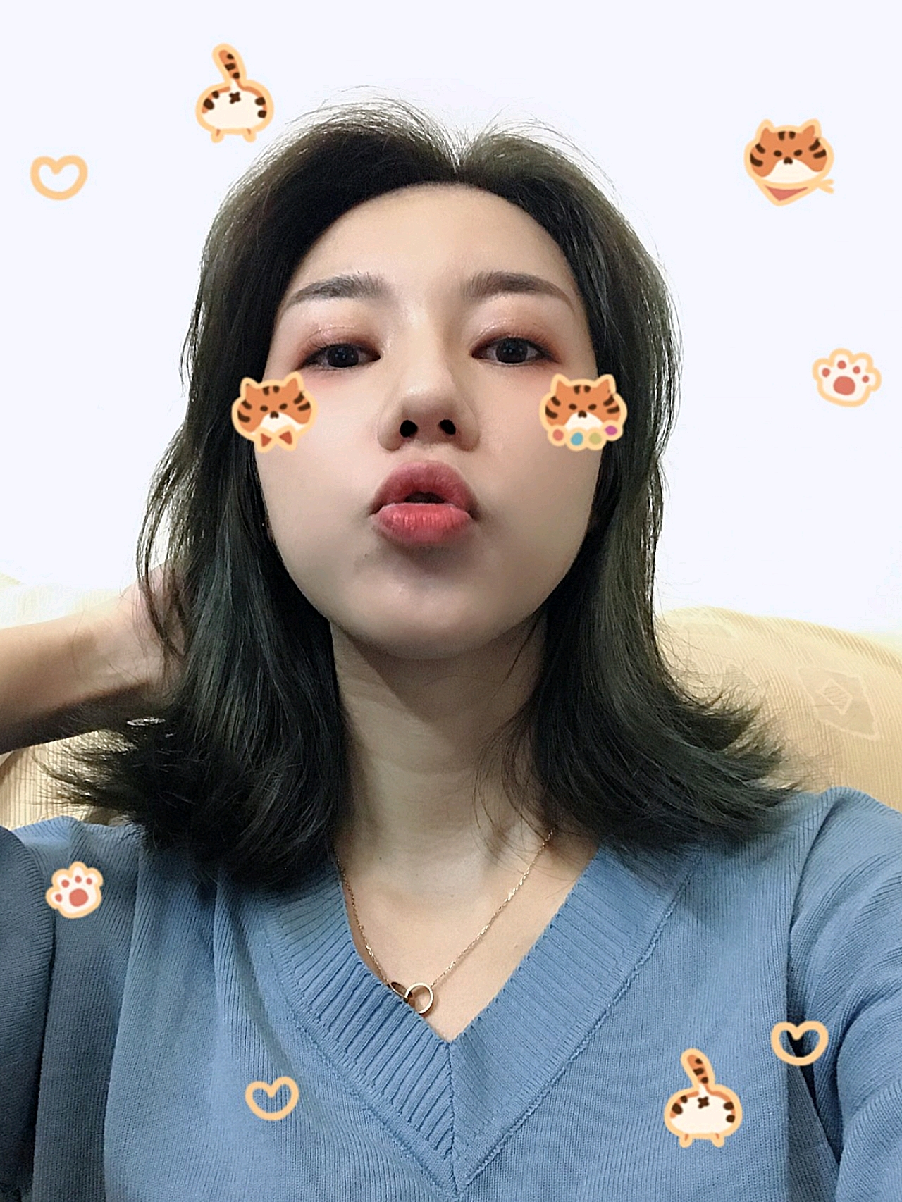 侧面真的*耐看的,鼻梁变得高挺了 上海鲁南柴云于景浩做隆鼻和双眼皮技术怎么样?价格多少钱?