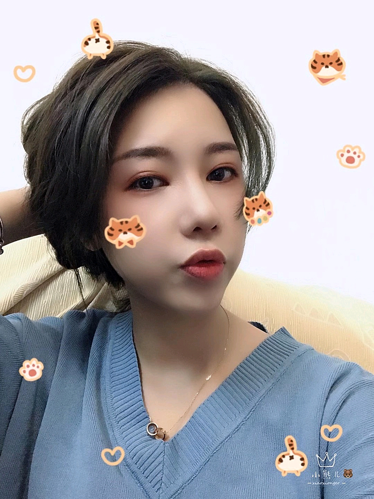 侧面真的*耐看的,鼻梁变得高挺了 上海鲁南柴云于景浩做隆鼻和双眼皮技术怎么样?价格多少钱?