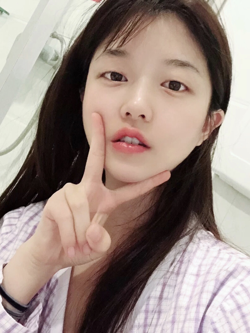 我之前鼻子做过*和打过玻尿酸,原始鼻子用我朋友的话来讲就是脸上只有个大鼻头。