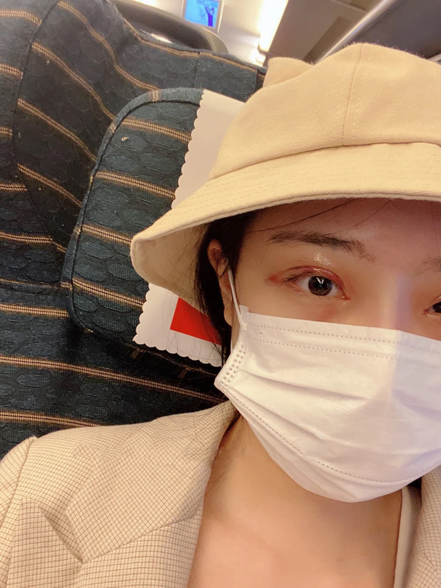 我之前鼻子做过*和打过玻尿酸,原始鼻子用我朋友的话来讲就是脸上只有个大鼻头。