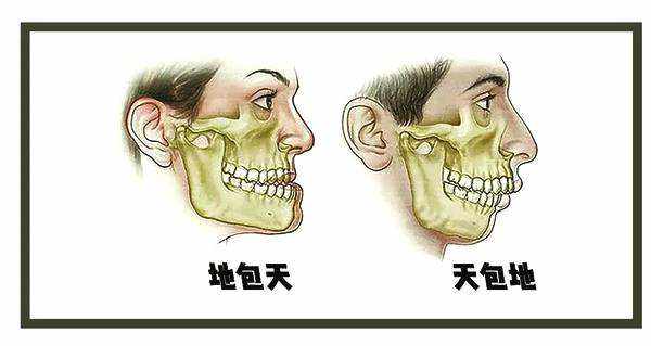 仙女姐姐刘亦菲的上颌前突天包地该怎么办?上鄂前突做天包地手术行吗?