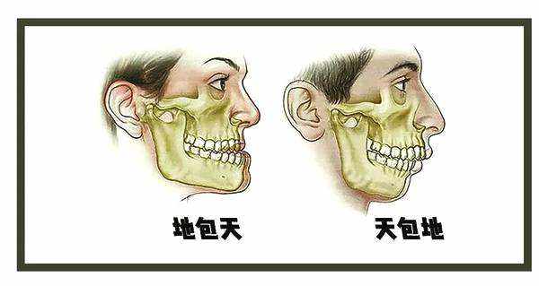 仙女姐姐刘亦菲的上颌前突天包地该怎么办？上鄂前突做天包地手术行吗？