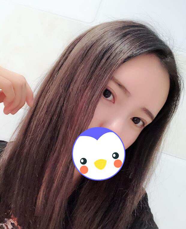 【郭鑫】北京医科整形八大处门诊部主任技术怎么样?面部吸脂案例图好看吗?