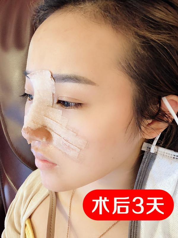 自测,你适合这款“直鼻”吗?