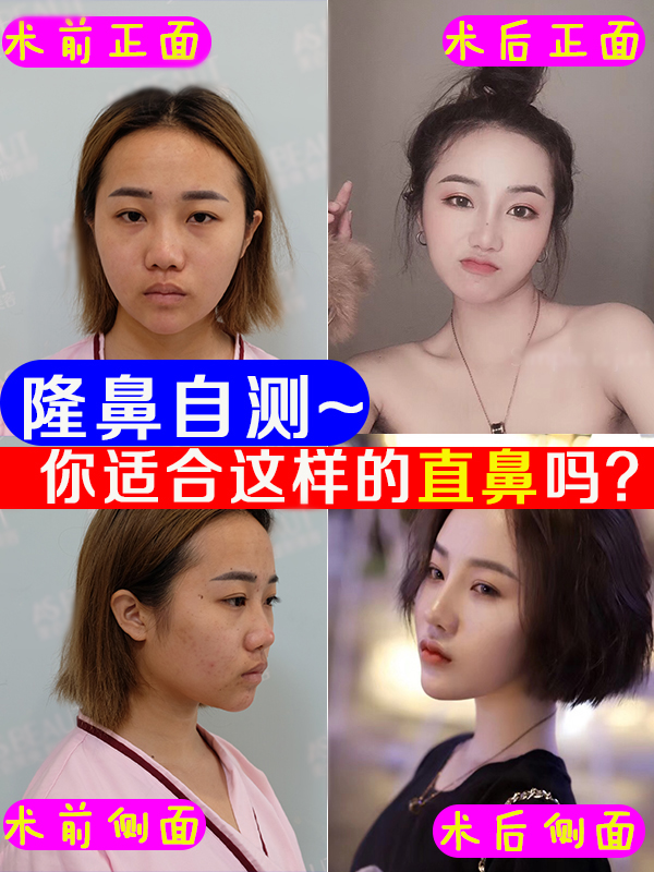 自测,你适合这款“直鼻”吗?