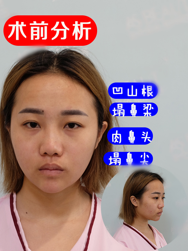 自测,你适合这款“直鼻”吗?
