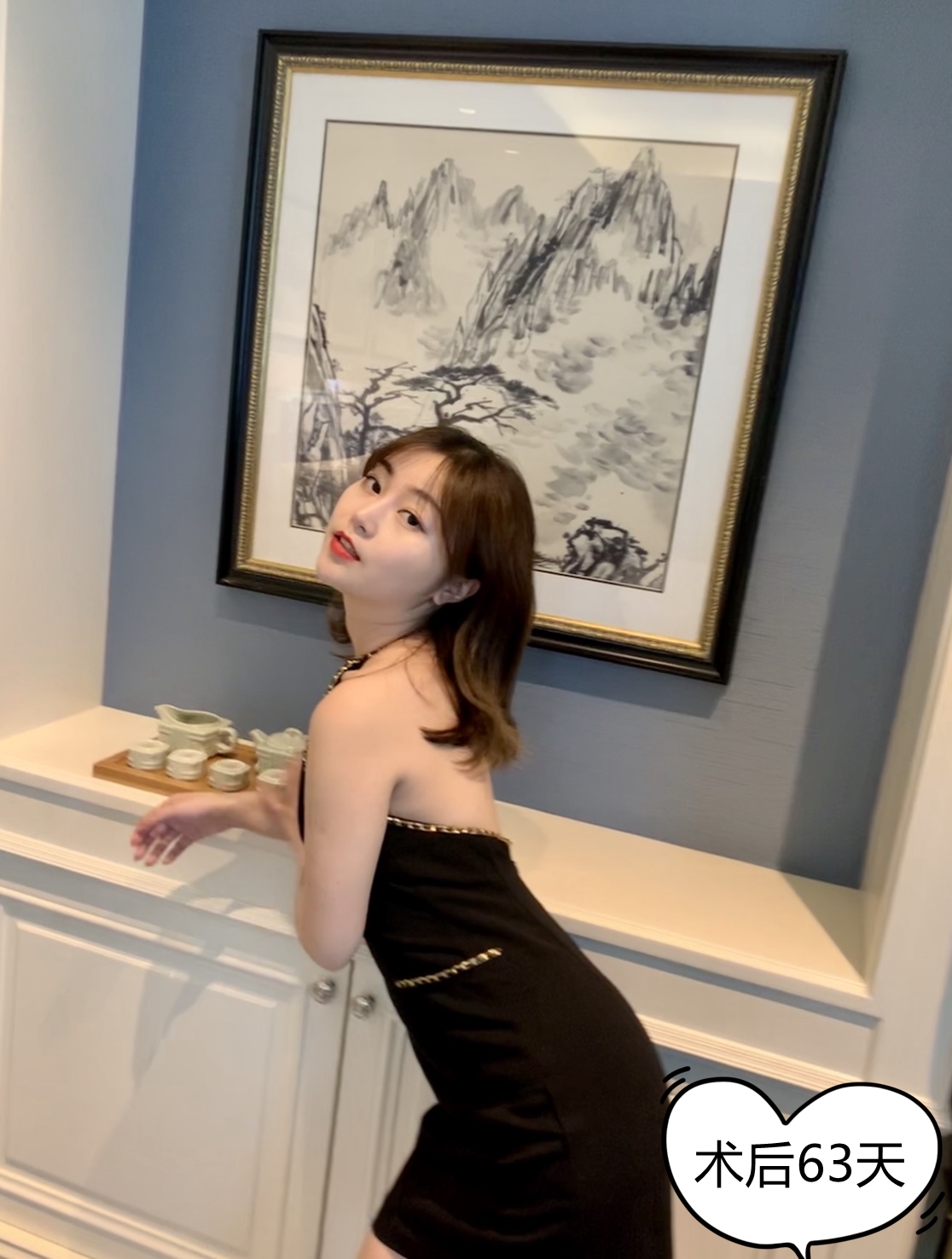 吸脂让她告别小肚腩变成迷人的小腰精!