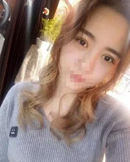 从小她就是单眼皮、小眼睛 成都米兰柏羽双眼皮高亮割的怎么样?案例图有吗?多少钱?