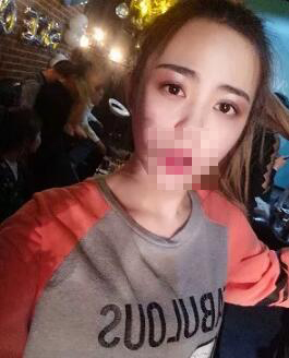 从小她就是单眼皮、小眼睛 成都米兰柏羽双眼皮高亮割的怎么样?案例图有吗?多少钱?