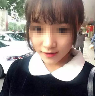 脸型太过肥大了一直是我的烦恼*注射 广州曙光打*多少钱?*果图怎么样?案例图