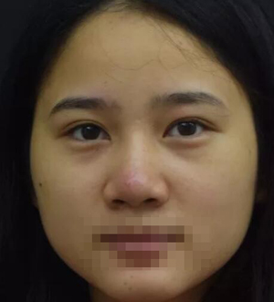 不良的作息习惯导致了我睡眠不足,因此眼部产生了很浓的眼袋