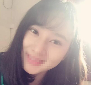 不良的作息习惯导致了我睡眠不足,因此眼部产生了很浓的眼袋
