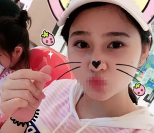 不良的作息习惯导致了我睡眠不足,因此眼部产生了很浓的眼袋