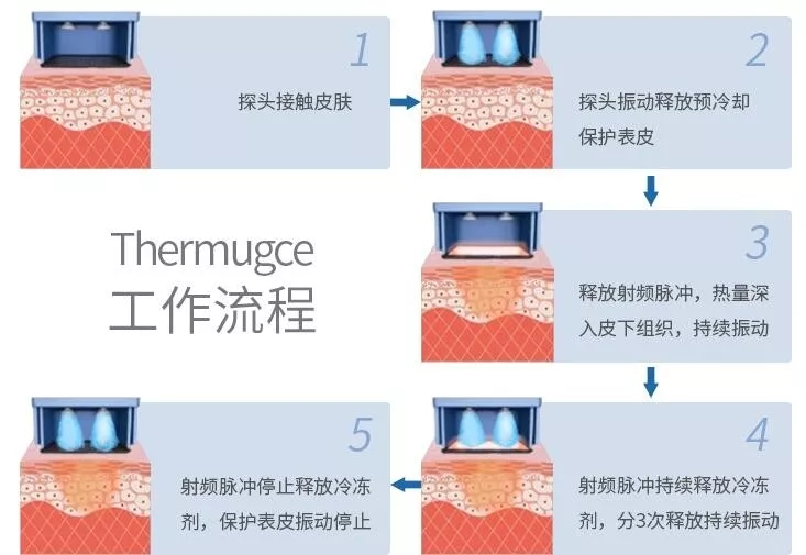 热玛吉紧肤多少钱?多少岁适合做热玛吉?