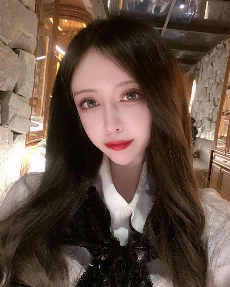 鼻头大,鼻翼宽,鼻子不秀气,鼻梁低平,缺少少女感 定制综合隆鼻改变了我
